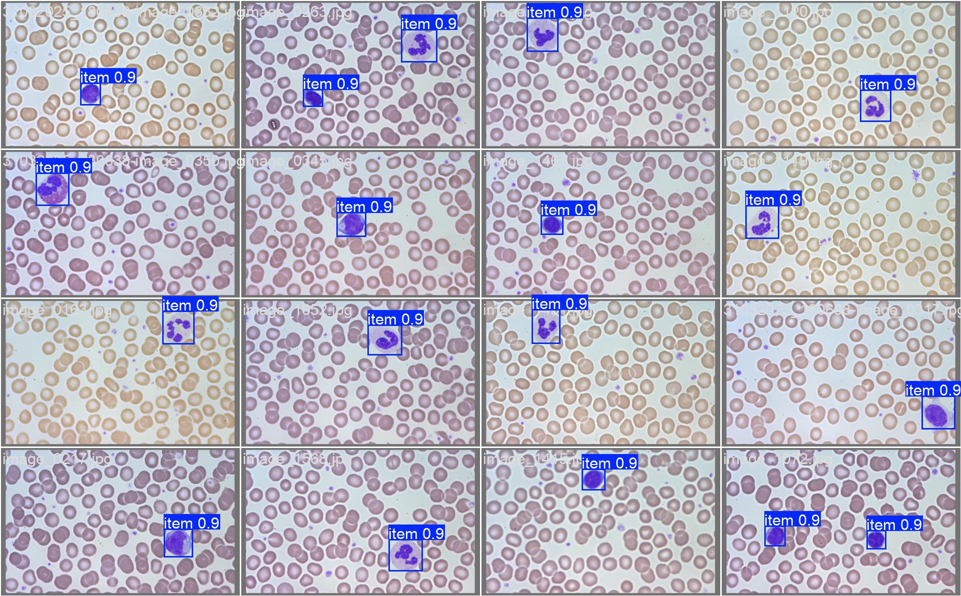 Microscopy blood smear images with detected white blood cells marked by bounding boxes